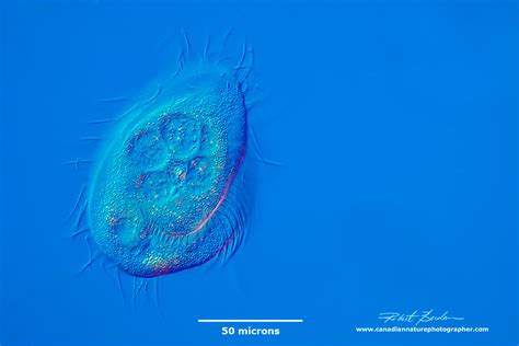  Urotrichus!  An Intriguing Ciliate That Swims Like a Tiny Ballet Dancer With a Thousand Cilia