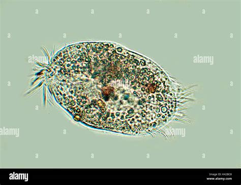  Zoothamnium! An Intriguing Ciliate With Tentacle-Like Cilia 